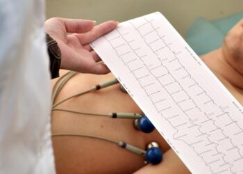 Електрокардіограма: просте обстеження, яке здатне попередити біду