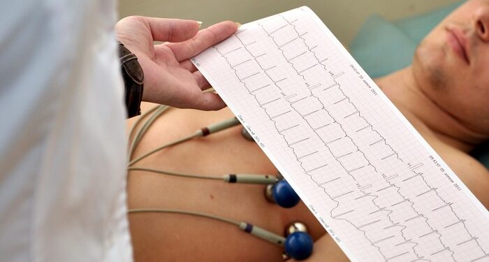 Електрокардіограма: просте обстеження, яке здатне попередити біду